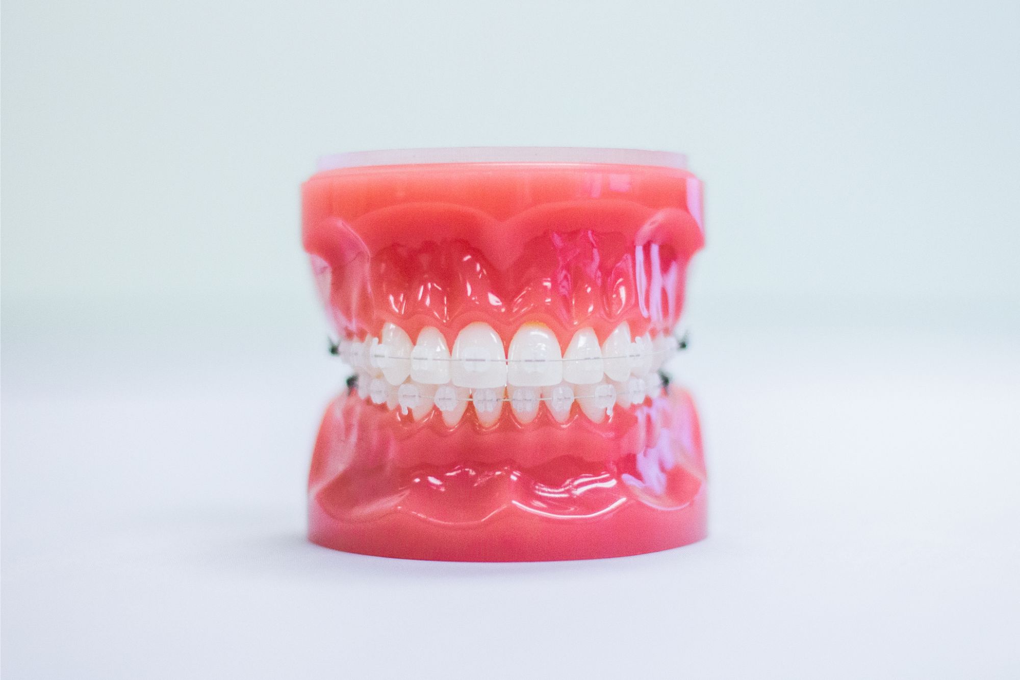 IMG_5857 orthodontics san diego