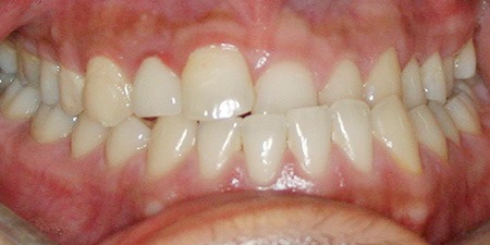 Before